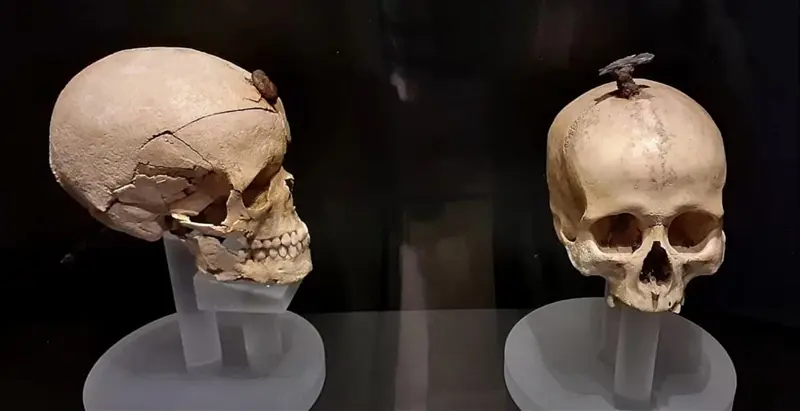 スペインで「巨大な釘が打ち込まれた頭蓋骨」が発見された！ 3000年前